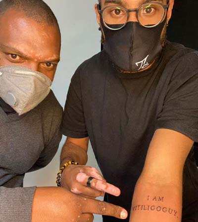 Damien Laventure, mannequin vitiligo, s’est fait tatouer chez lui.