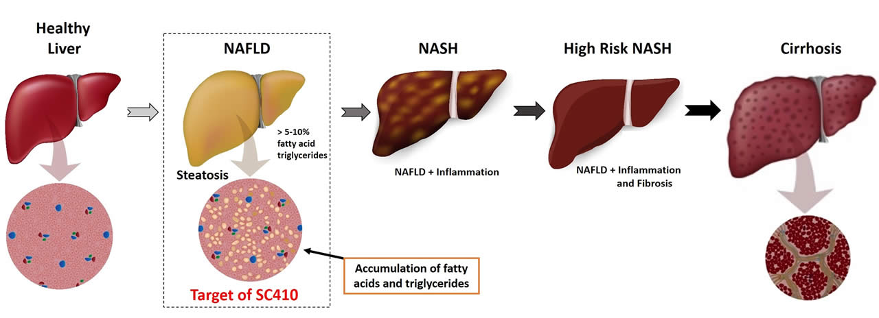 Liver