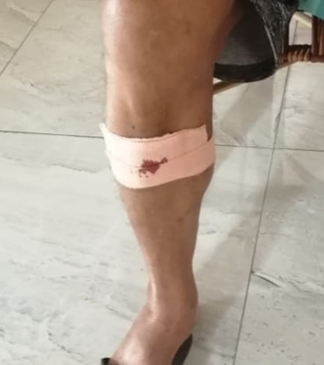 La victime a été blessée  à la jambe.